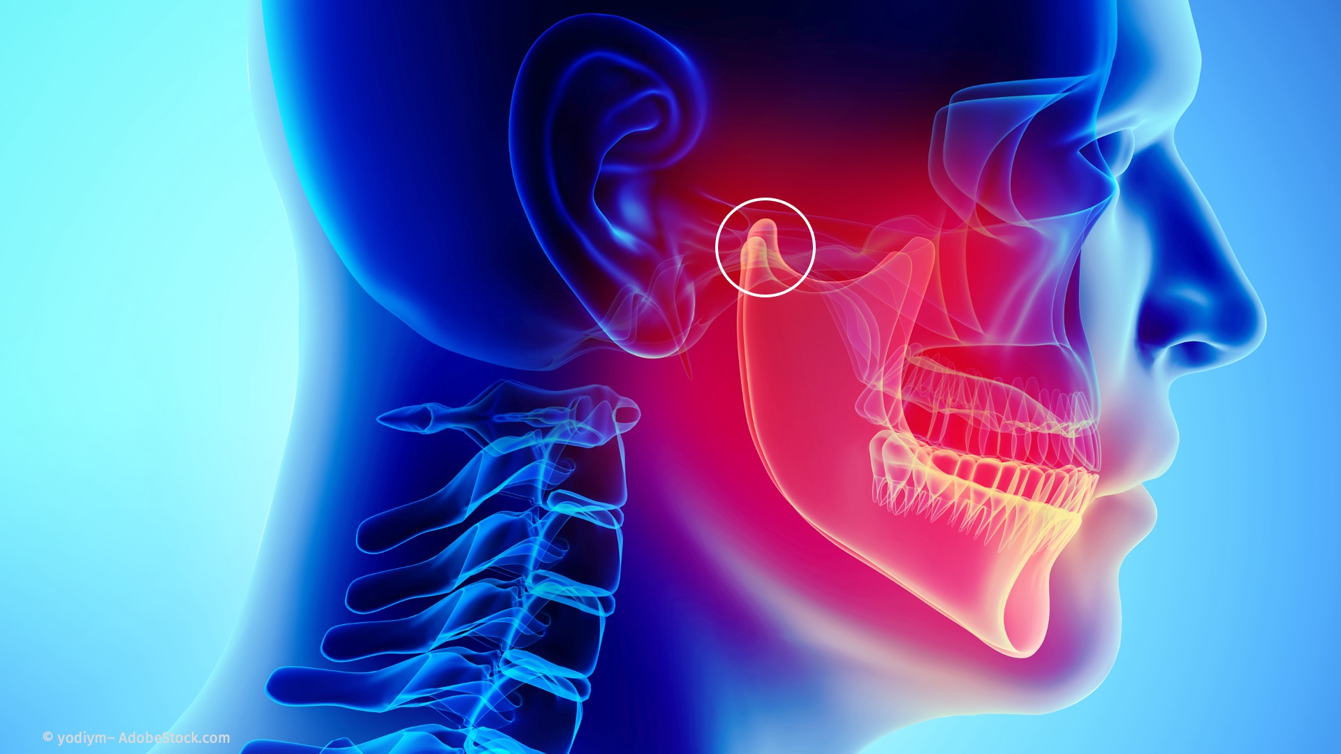 CMD: Störungen der Kiefergelenke und der Kaumuskulatur